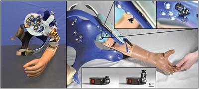 Long-Term Home-Use of Sensory-Motor-Integrated Bidirectional Bionic Prosthetic Arms Promotes Functional, Perceptual, and Cognitive Changes